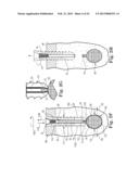 FIXATION SYSTEM FOR ORTHOPEDIC DEVICES diagram and image