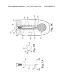 FIXATION SYSTEM FOR ORTHOPEDIC DEVICES diagram and image