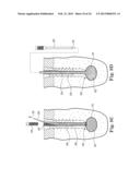 FIXATION SYSTEM FOR ORTHOPEDIC DEVICES diagram and image