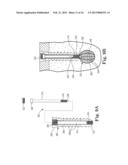 FIXATION SYSTEM FOR ORTHOPEDIC DEVICES diagram and image