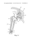 FIXATION SYSTEM FOR ORTHOPEDIC DEVICES diagram and image