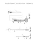 FIXATION SYSTEM FOR ORTHOPEDIC DEVICES diagram and image