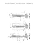 FIXATION SYSTEM FOR ORTHOPEDIC DEVICES diagram and image