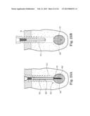 FIXATION SYSTEM FOR ORTHOPEDIC DEVICES diagram and image