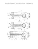 FIXATION SYSTEM FOR ORTHOPEDIC DEVICES diagram and image