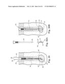 FIXATION SYSTEM FOR ORTHOPEDIC DEVICES diagram and image