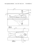 IMPLANTABLE CARDIOVERTER DEFIBRILLATOR DESIGNED FOR USE IN A MAGNETIC     RESONANCE IMAGING ENVIRONMENT diagram and image