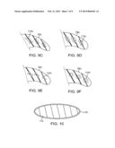 MOLDABLE CHARGER WITH SHAPE-SENSING MEANS FOR AN IMPLANTABLE PULSE     GENERATOR diagram and image