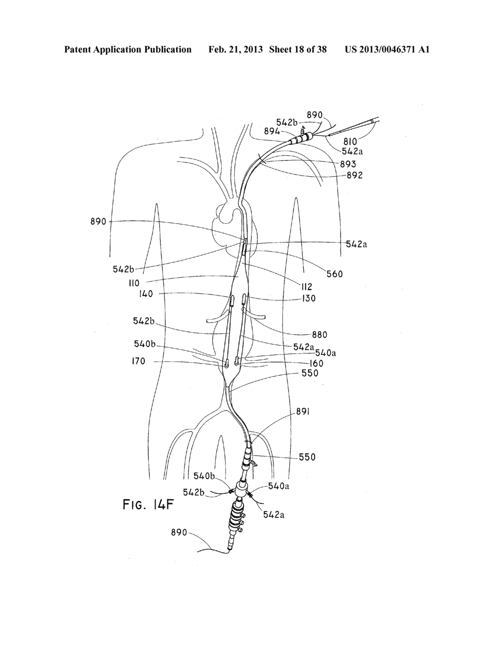 ENDOLUMINAL PROSTHESIS HAVING MULTIPLE BRANCHES OR FENESTRATIONS AND     METHODS OF DEPLOYMENT - diagram, schematic, and image 19
