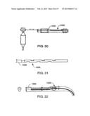 Apparatus for Replacing a Cardiac Valve diagram and image