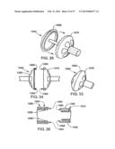 Apparatus for Replacing a Cardiac Valve diagram and image