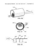 Apparatus for Replacing a Cardiac Valve diagram and image