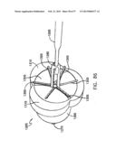 Apparatus for Replacing a Cardiac Valve diagram and image