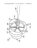 Apparatus for Replacing a Cardiac Valve diagram and image