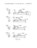 Apparatus for Replacing a Cardiac Valve diagram and image