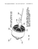 Apparatus for Replacing a Cardiac Valve diagram and image