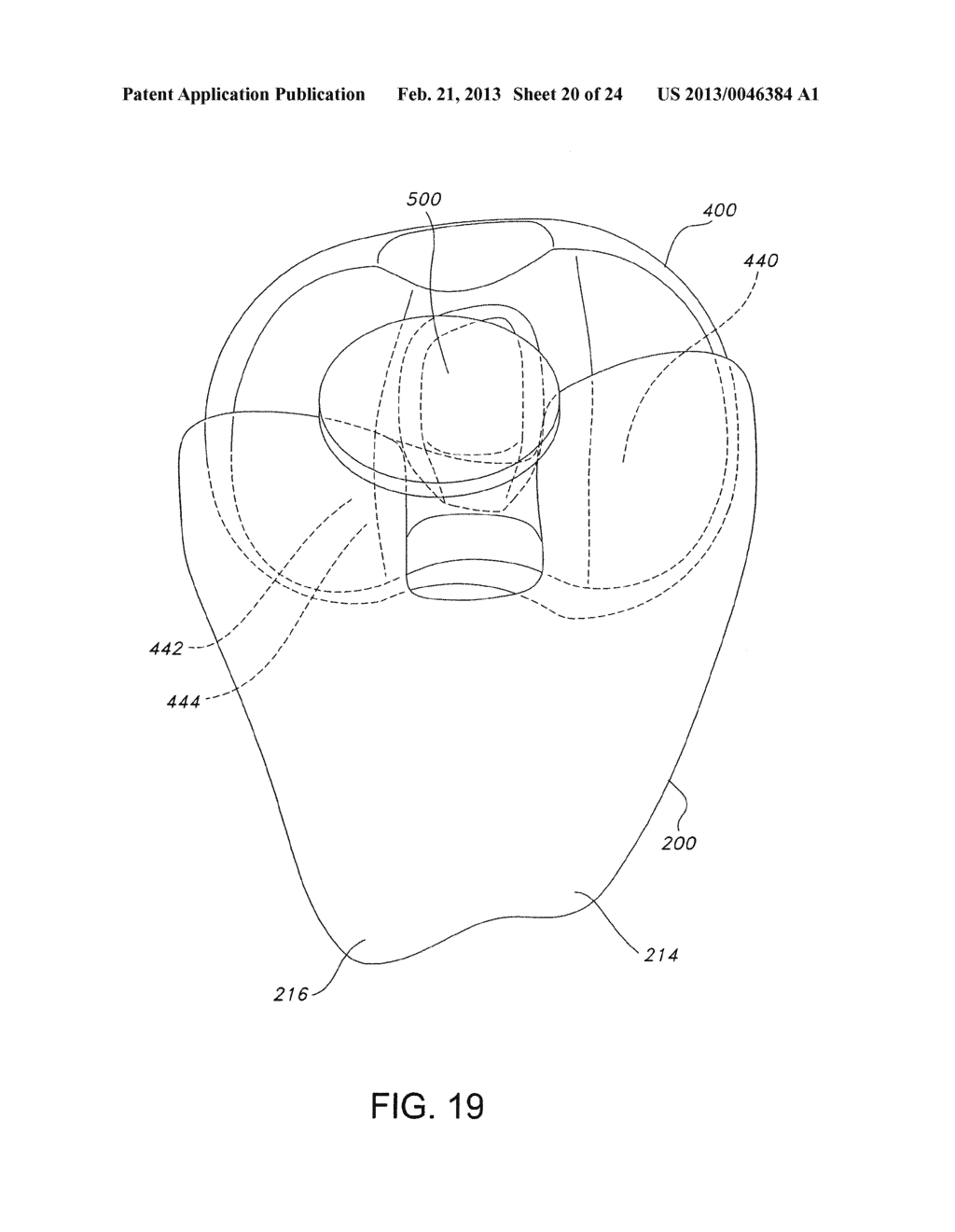 HIGH PERFORMANCE KNEE PROSTHESES - diagram, schematic, and image 21