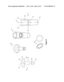 TOE JOINT REPLACEMENT MODELS diagram and image