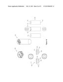 TOE JOINT REPLACEMENT MODELS diagram and image