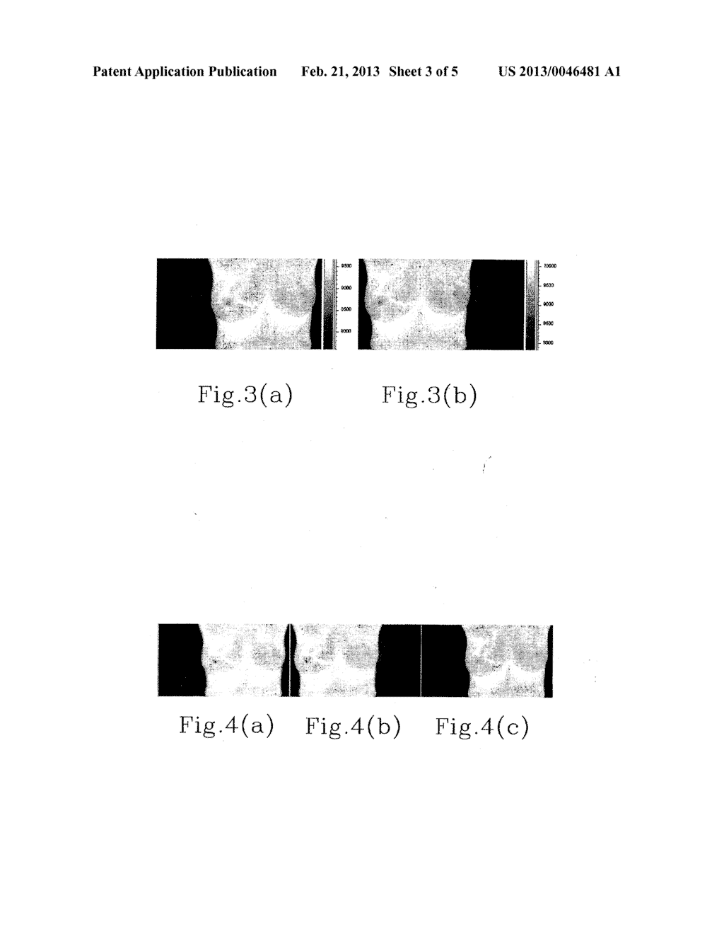 Dual-Spectrum Heat Pattern Separation Algorithm For Assessing Chemotherapy     Treatment Response And Early Detection - diagram, schematic, and image 04