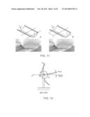 VORTEX-INDUCED CLEANING OF SURFACES diagram and image