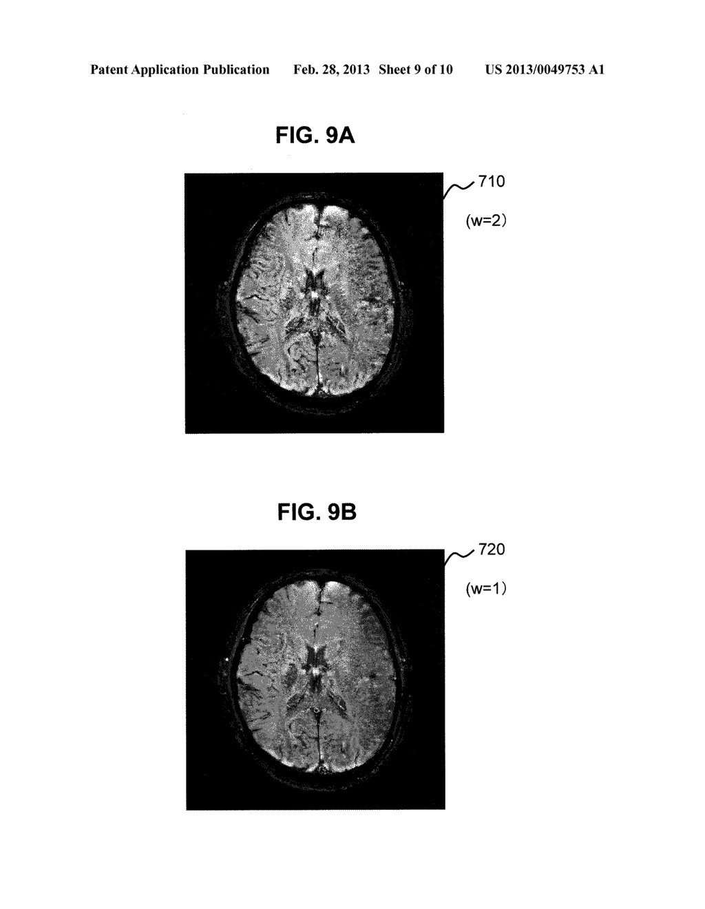 MAGNETIC RESONANCE IMAGING APPARATUS - diagram, schematic, and image 10