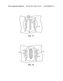 Fluid Level Sensing System And Method diagram and image