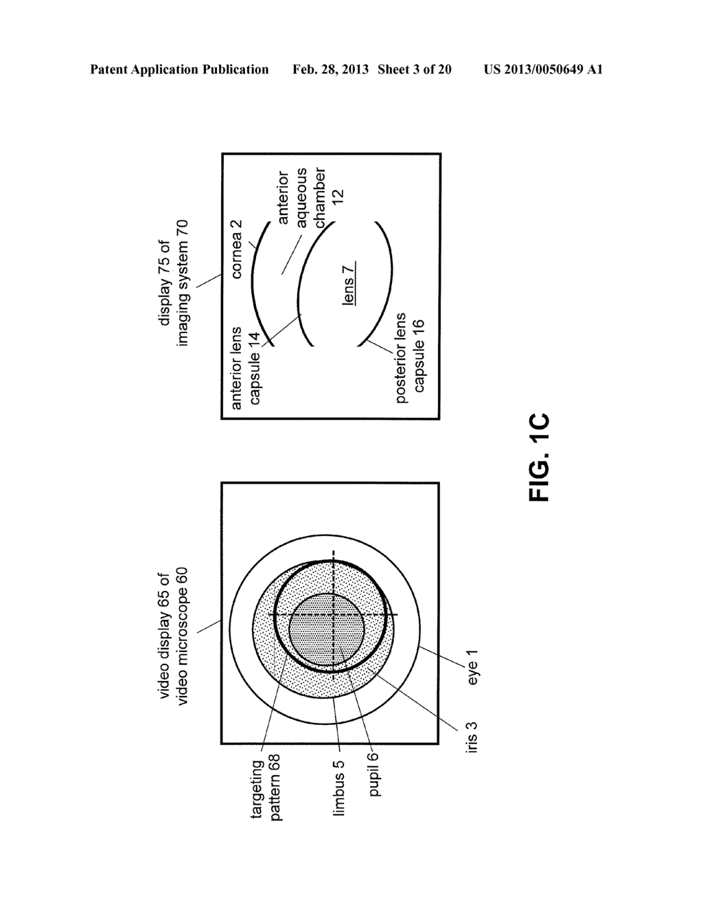 IMAGING-BASED GUIDANCE SYSTEM FOR OPHTHALMIC DOCKING USING A     LOCATION-ORIENTATION ANALYSIS - diagram, schematic, and image 04