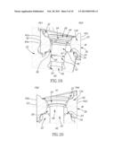 Cutting Tool and Cutting Insert Having Clamping Bore with Spaced Apart     Clamping Portions Therefor diagram and image