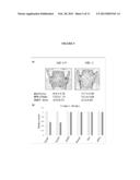 COMPOUNDS AND METHODS FOR INHIBITING SEROTONIN SYNTHESIS diagram and image