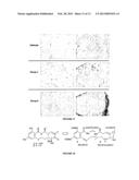 IRREVERSIBLE INHIBITORS USEFUL FOR THE TREATMENT OF KINASE-RELATED     PATHOLOGIES diagram and image