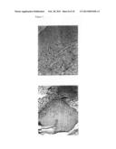 PHARMACEUTICAL COMPOSITIONS COMPRISING LIGNANS AND THEIR DERIVATIVES FOR     THE MEDICAL MANAGEMENT OF ANGIOGENESIS AND HYPOVASCULARITY diagram and image