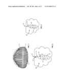 METHODS AND SYSTEMS FOR TREATING MEIBOMIAN GLAND DYSFUNCTION USING     RADIO-FREQUENCY ENERGY diagram and image