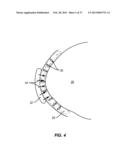 METHODS AND SYSTEMS FOR TREATING MEIBOMIAN GLAND DYSFUNCTION USING     RADIO-FREQUENCY ENERGY diagram and image