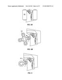 METHODS AND SYSTEMS FOR TREATING MEIBOMIAN GLAND DYSFUNCTION USING     RADIO-FREQUENCY ENERGY diagram and image