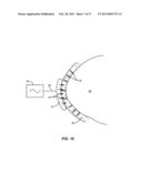 METHODS AND SYSTEMS FOR TREATING MEIBOMIAN GLAND DYSFUNCTION USING     RADIO-FREQUENCY ENERGY diagram and image