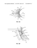 METHODS AND SYSTEMS FOR TREATING MEIBOMIAN GLAND DYSFUNCTION USING     RADIO-FREQUENCY ENERGY diagram and image