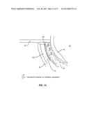 METHODS AND SYSTEMS FOR TREATING MEIBOMIAN GLAND DYSFUNCTION USING     RADIO-FREQUENCY ENERGY diagram and image