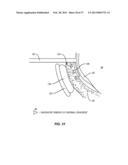 METHODS AND SYSTEMS FOR TREATING MEIBOMIAN GLAND DYSFUNCTION USING     RADIO-FREQUENCY ENERGY diagram and image