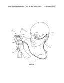 METHODS AND SYSTEMS FOR TREATING MEIBOMIAN GLAND DYSFUNCTION USING     RADIO-FREQUENCY ENERGY diagram and image