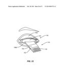 METHODS AND SYSTEMS FOR TREATING MEIBOMIAN GLAND DYSFUNCTION USING     RADIO-FREQUENCY ENERGY diagram and image