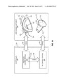 METHODS AND SYSTEMS FOR TREATING MEIBOMIAN GLAND DYSFUNCTION USING     RADIO-FREQUENCY ENERGY diagram and image