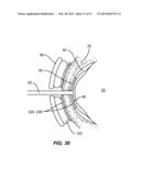 METHODS AND SYSTEMS FOR TREATING MEIBOMIAN GLAND DYSFUNCTION USING     RADIO-FREQUENCY ENERGY diagram and image