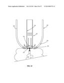 METHODS AND SYSTEMS FOR TREATING MEIBOMIAN GLAND DYSFUNCTION USING     RADIO-FREQUENCY ENERGY diagram and image