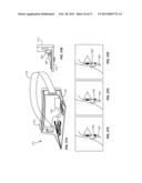 METHODS AND SYSTEMS FOR TREATING MEIBOMIAN GLAND DYSFUNCTION USING     RADIO-FREQUENCY ENERGY diagram and image