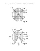 DEVICE FOR DETECTING MOISTURE FOR USE WITH A DEVICE FOR MONITORING AN     ACCESS TO A PATIENT, IN PARTICULAR FOR MONITORING THE VASCULAR ACCESS IN     AN EXTRACORPOREAL BLOOD TREATMENT diagram and image