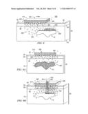 Tattoo Removal System and Method diagram and image