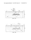 Tattoo Removal System and Method diagram and image