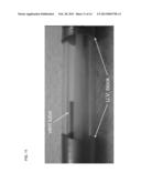 Triple Balloon Occlusion and Infusion Catheter diagram and image