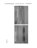 Triple Balloon Occlusion and Infusion Catheter diagram and image